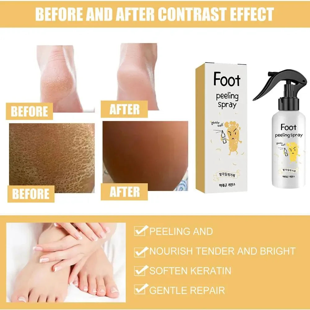 200ml Foot Peeling Spray Moisturizing Nourishing Foot Exfoliator Spray, Smoothing Feet Skin, Gently Exfoliates Rough Dry Skin Peaceful Pleasures Health and Wellness