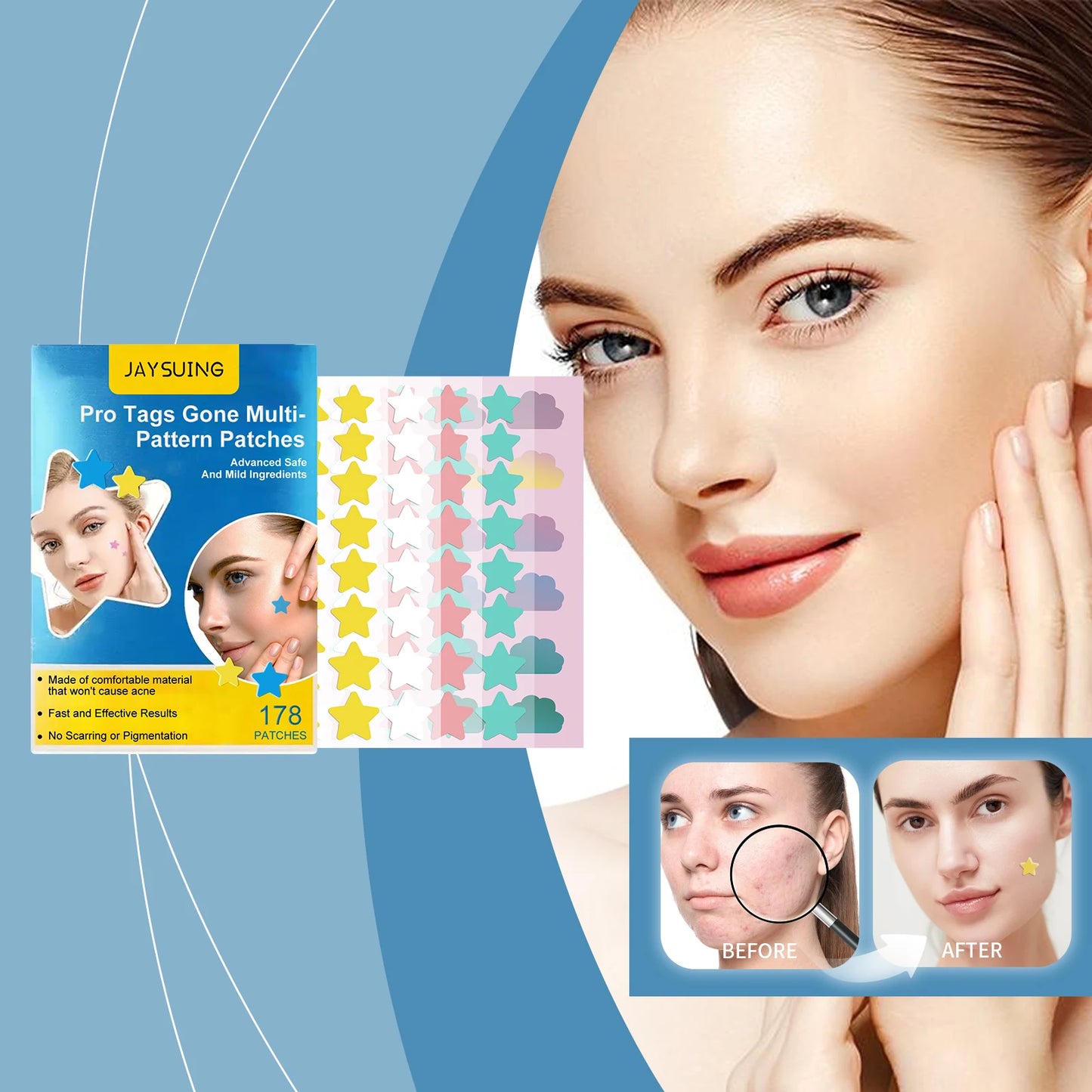178-Pc Colorful Hydrocolloid Acne Patches – Stars & Clouds