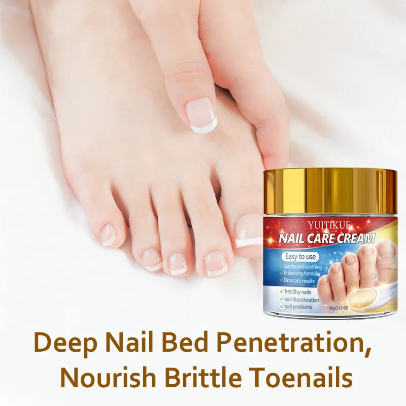 Yuitikue Nail Care Cream, 60g Gentle Nail Repair Cream for Nail Discoloration & Nail Problems, Promoting Healthy Nails Peaceful Pleasures Health and Wellness