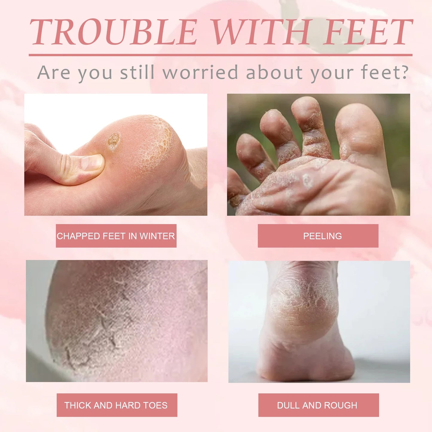 Peach Exfoliating Foot Mask Booties | Dead Skin Removal Socks