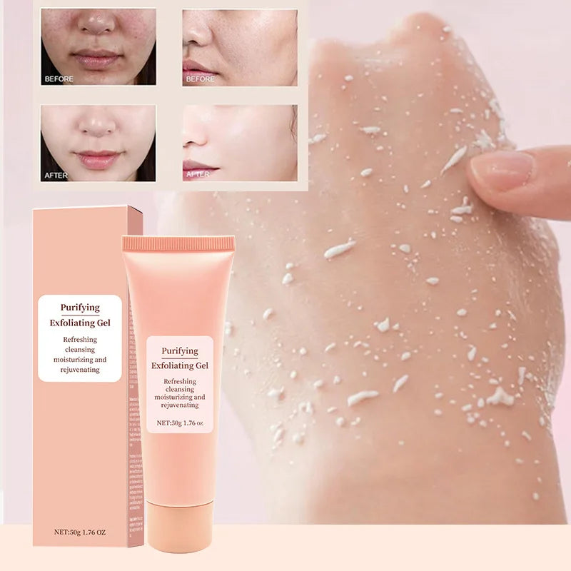 50g Facial Exfoliating Gel – Pore Cleanser & Oil Control Scrub