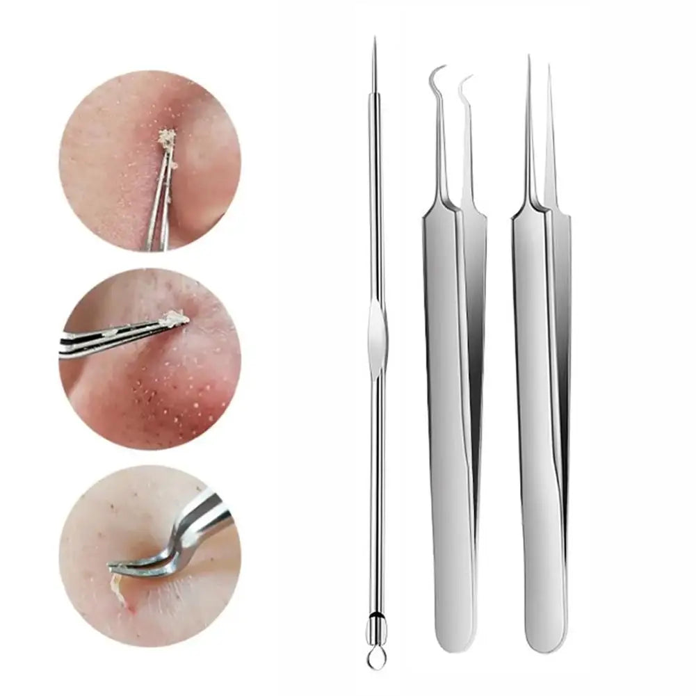 3-Piece Acne Needle Blackhead Extractor Kit | Stainless Steel