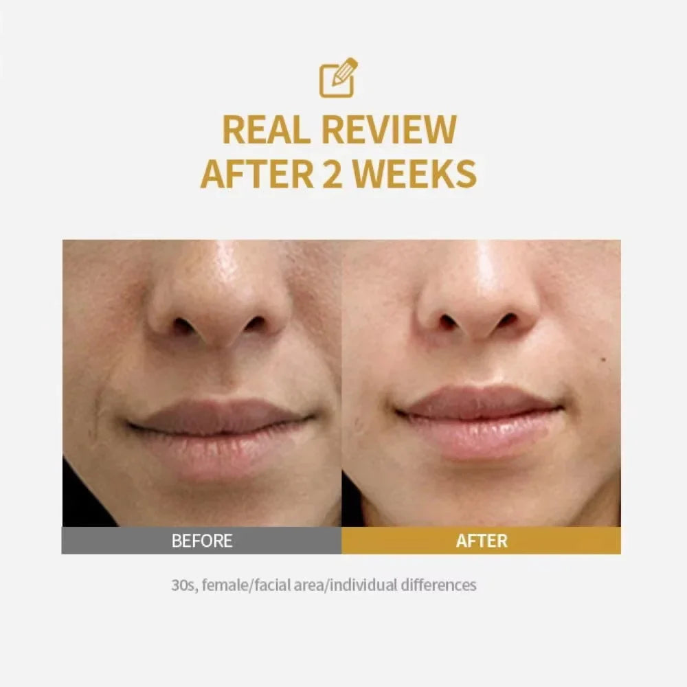 Peptide Lifting Ampoule – Collagen Firming & Hydrating Face Serum