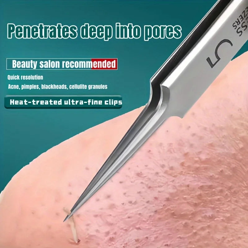 Stainless Steel Blackhead & Whitehead Extractor Tool