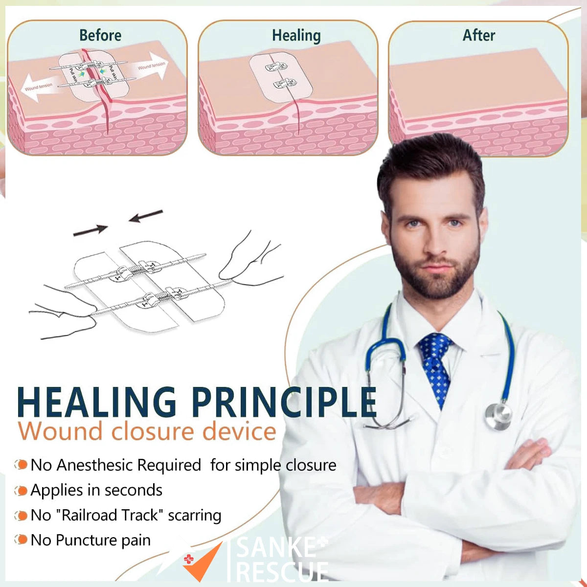 Zipper Band-aid Painless Wound Closure Device Suture-free Wound Dressing Patches Zip Suture Reducer Band Aid Peaceful Pleasures Health and Wellness
