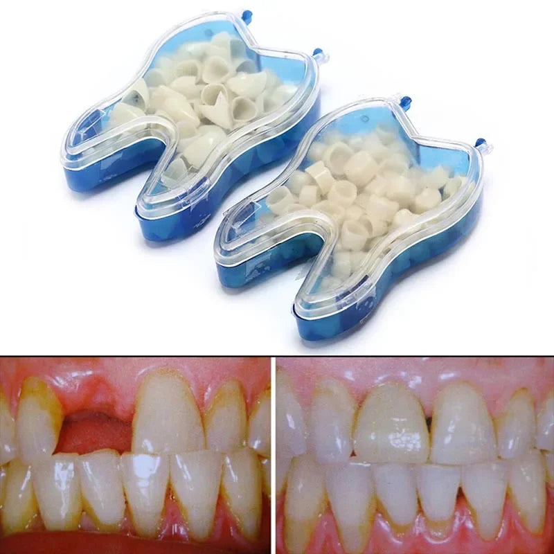 50pcs Dental Temporary Crown Teeth Anterior Posterior Dentist Materials Dental Tools Dentistry Equipment Peaceful Pleasures Health and Wellness