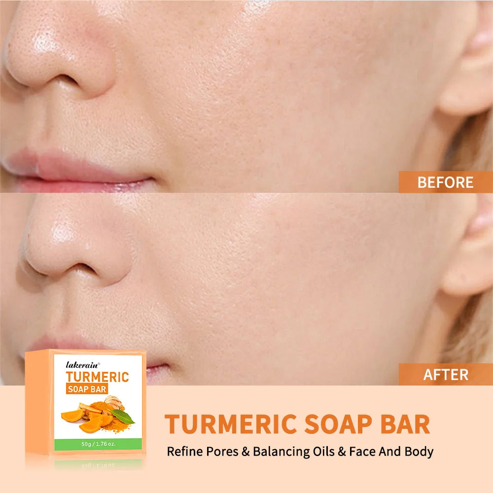 Handmade Turmeric Soap – Brightening Bar for Dark Spots & Face Brightening Soap Bar Peaceful Pleasures Health and Wellness