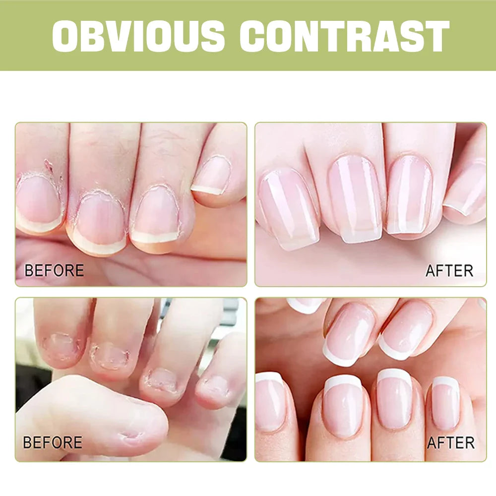 EJW Cuticle Oil – Nourishing Nail & Cuticle Treatment