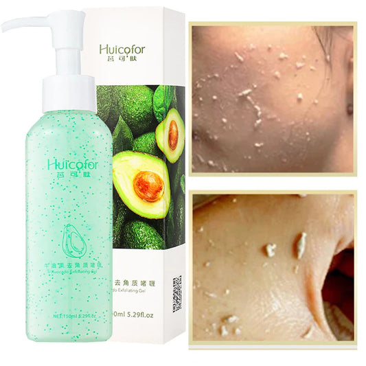 Fruit Acid Peeling Gel 120ml Facial Cleansing Exfoliating Peeling Scrub Deep Clean Acne Blackhead Remove Face Cleanser Peaceful Pleasures Health and Wellness