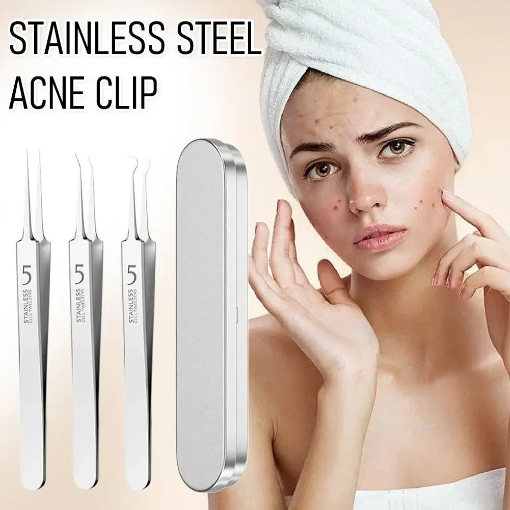 Professional Facial Blackhead Remover Tweezers,3Pcs Precision Pimple Popper Tool Kit for Whitehead Ance Blemishs Comedones Peaceful Pleasures Health and Wellness