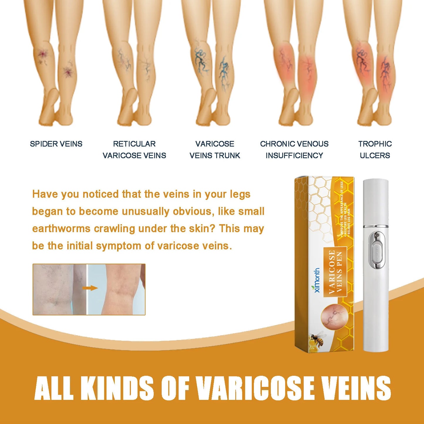 Leg Massager Roller – Soothe Tired Legs & Muscle Discomfort