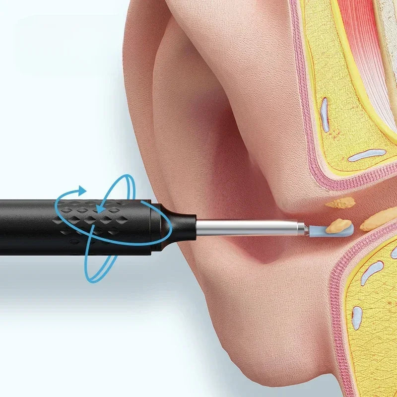 Visual Ear Cleaner With Camera LED Lights 4.0mm Lens Ear Wax Removal Tool Take Video HD Earpick Gifts Peaceful Pleasures Health and Wellness