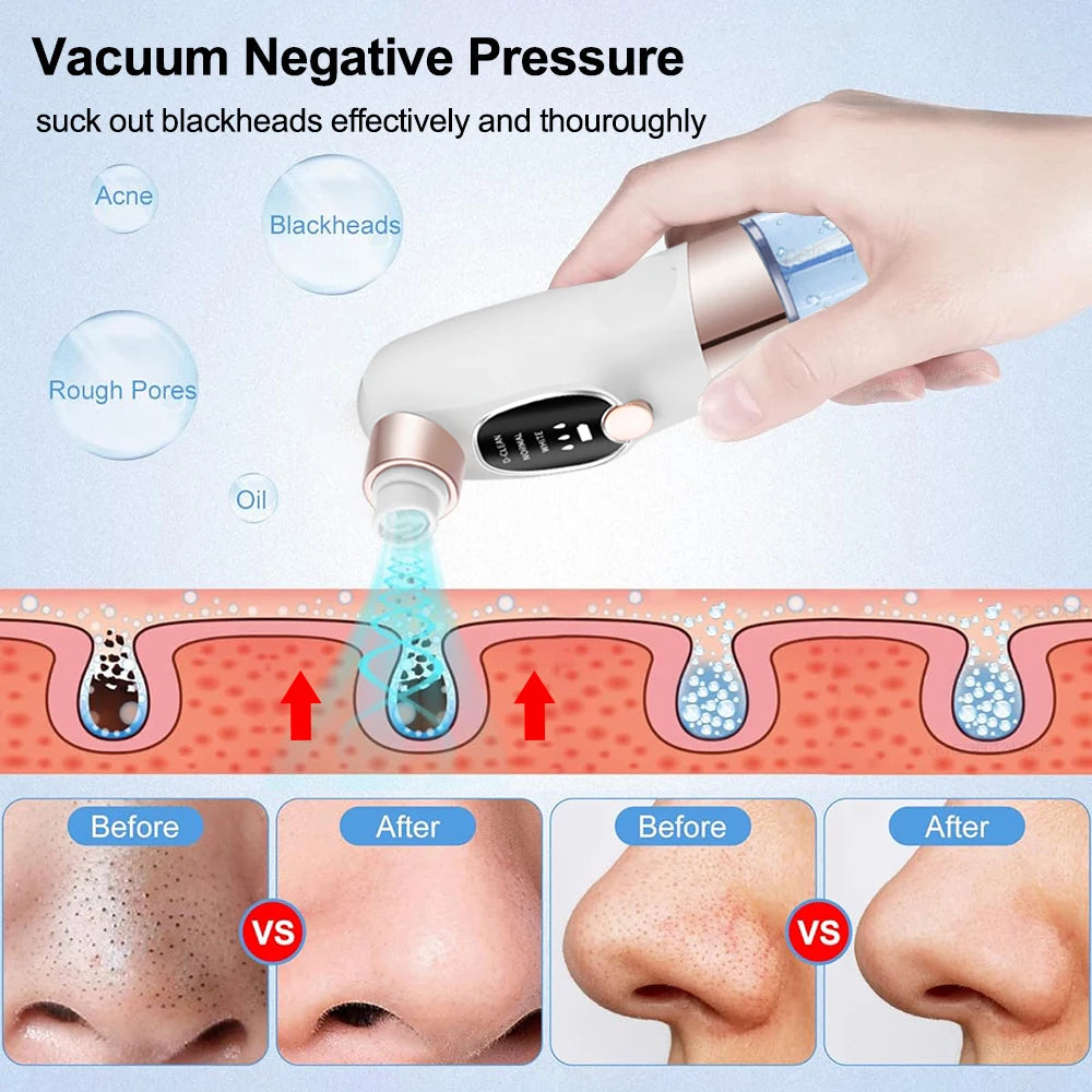 Blackhead Remover Pore Vacuum Cleaner Face Black Dot Pimple Acne Remover Electric Blackhead Vacuum Cleaner Black Point Extractor Peaceful Pleasures Health and Wellness