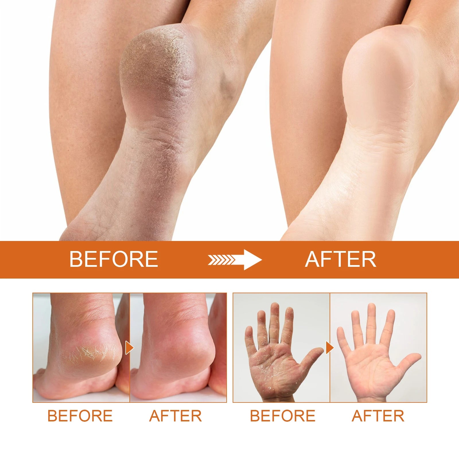 Jaysuing Exfoliating Foot Treatment Spray Remove Dead Skin Care Repair Skin Cracks Replenish Moisture Moisturize Soften Footcare Peaceful Pleasures Health and Wellness