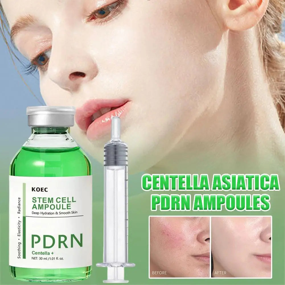 PDRN Centella Ampoule Face Serum Radiance Deep Hydration Serum, Soothing & Elasticity for Smooth Skin Care 30ml Peaceful Pleasures Health and Wellness