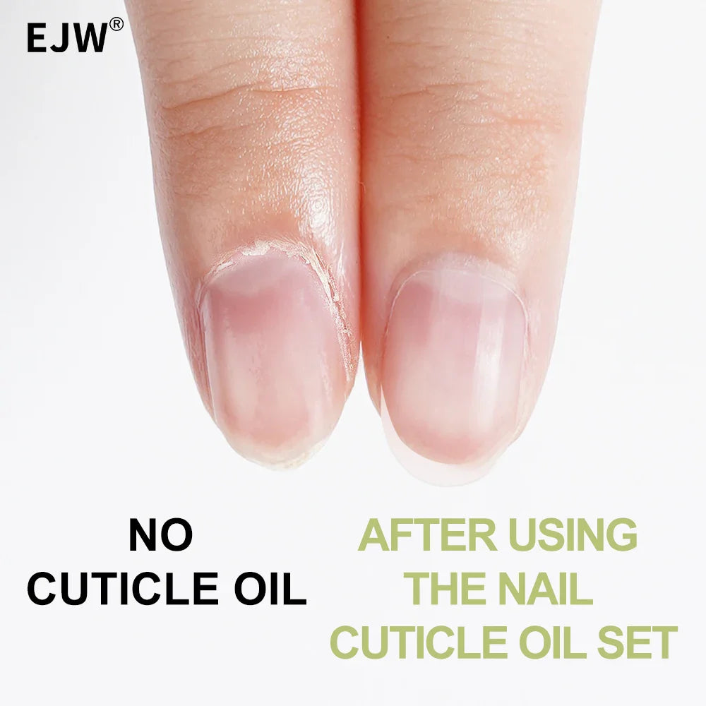 EJW Cuticle Oil – Nourishing Nail & Cuticle Treatment