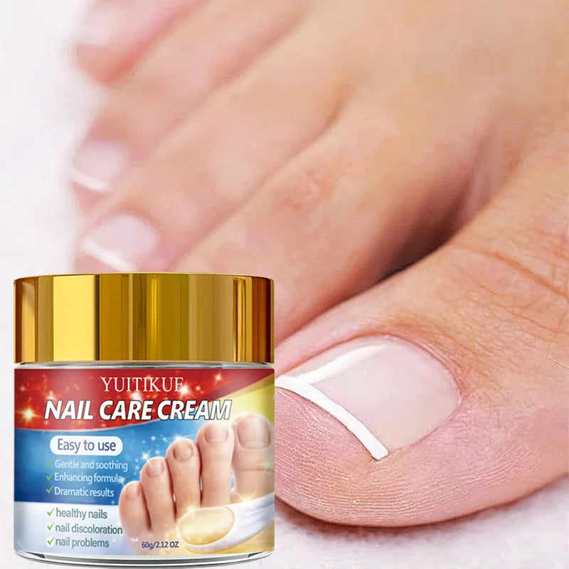 Yuitikue Nail Care Cream, 60g Gentle Nail Repair Cream for Nail Discoloration & Nail Problems, Promoting Healthy Nails Peaceful Pleasures Health and Wellness