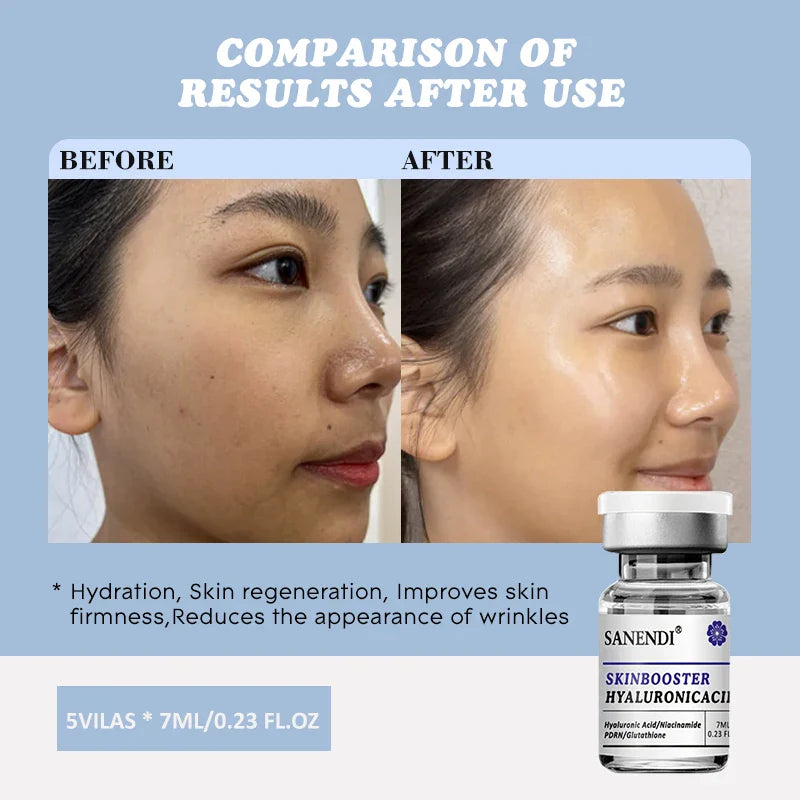 Sanendi Hyaluronic Acid PDRN Glutathione Retinol Serum 5×7ml