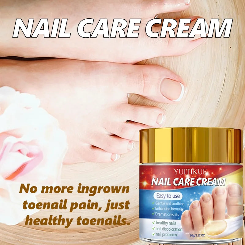 Yuitikue Nail Care Cream, 60g Gentle Nail Repair Cream for Nail Discoloration & Nail Problems, Promoting Healthy Nails Peaceful Pleasures Health and Wellness