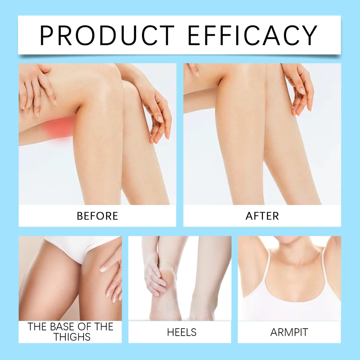 Jaysuing Anti-Friction Cream Stick | Thigh Chafe Guard 15g
