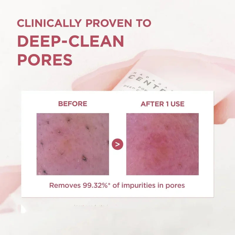 SKIN1004 Centella Poremizing Foam & Pink Salt Cleanser 125ml Peaceful Pleasures Health and Wellness