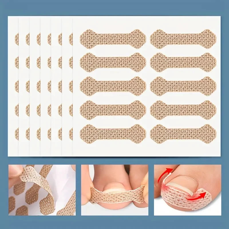 0pcs Toe Patch Set Get Relief from Ingrown Toenails & Enhance Nail Care with Orthopedic Support Nail pulling patch orthotics Peaceful Pleasures Health and Wellness
