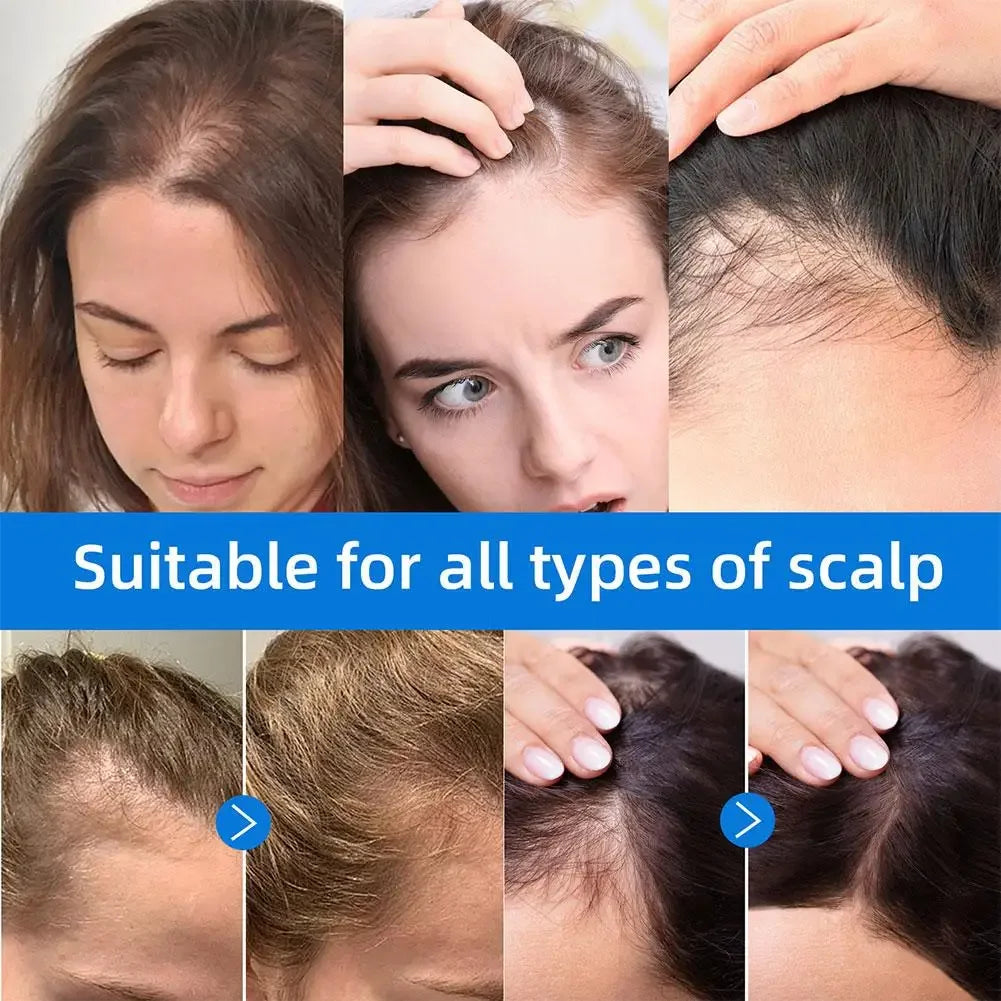 Seapuri Scalphy Hair Essence Rollerball Nourishing Anti-Frizz Hair Serum Refreshing Strengthening Hair Essence Scalp Treatment Peaceful Pleasures Health and Wellness