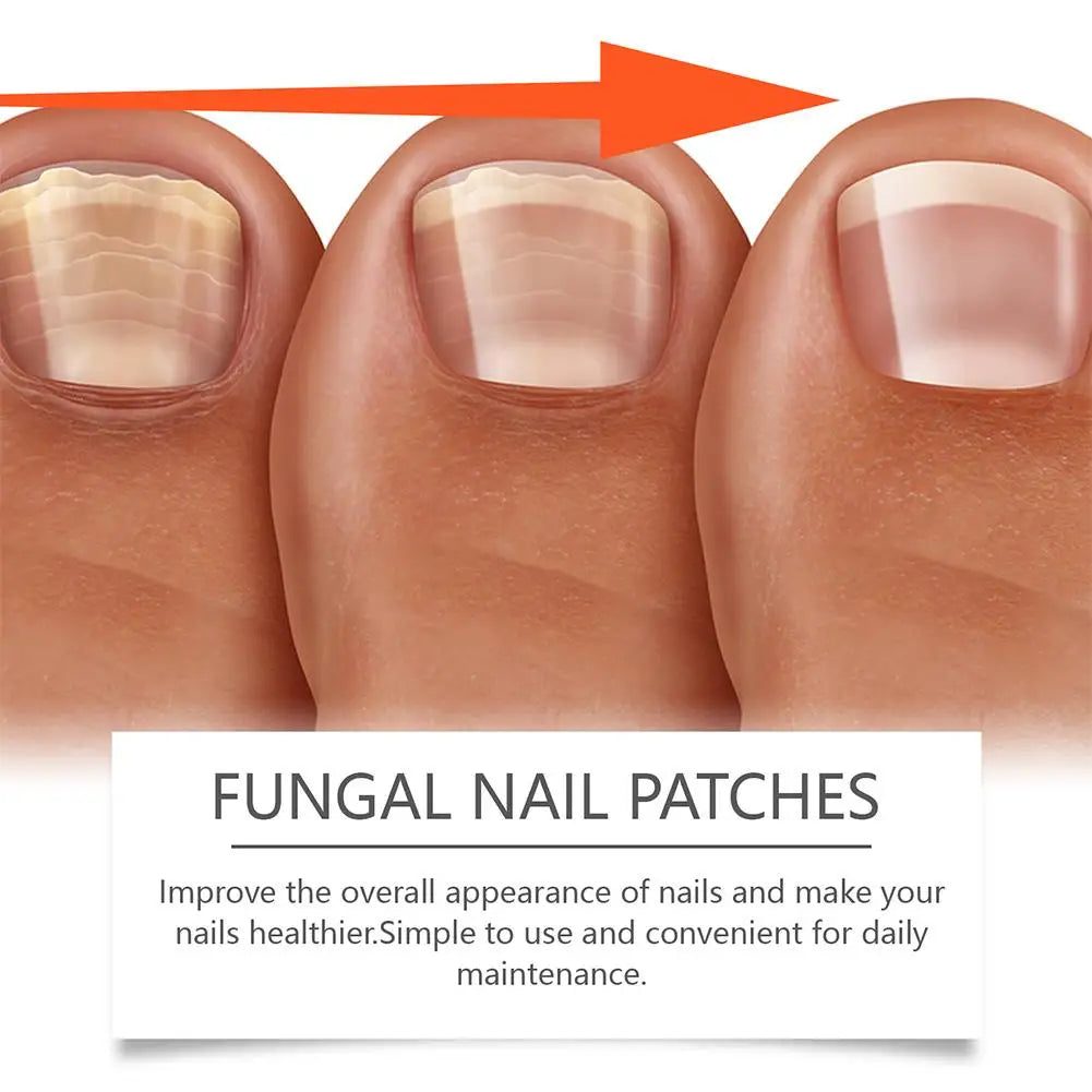 Nail Care Repair Patch – Nourishing & Protective | 1-3 Pcs