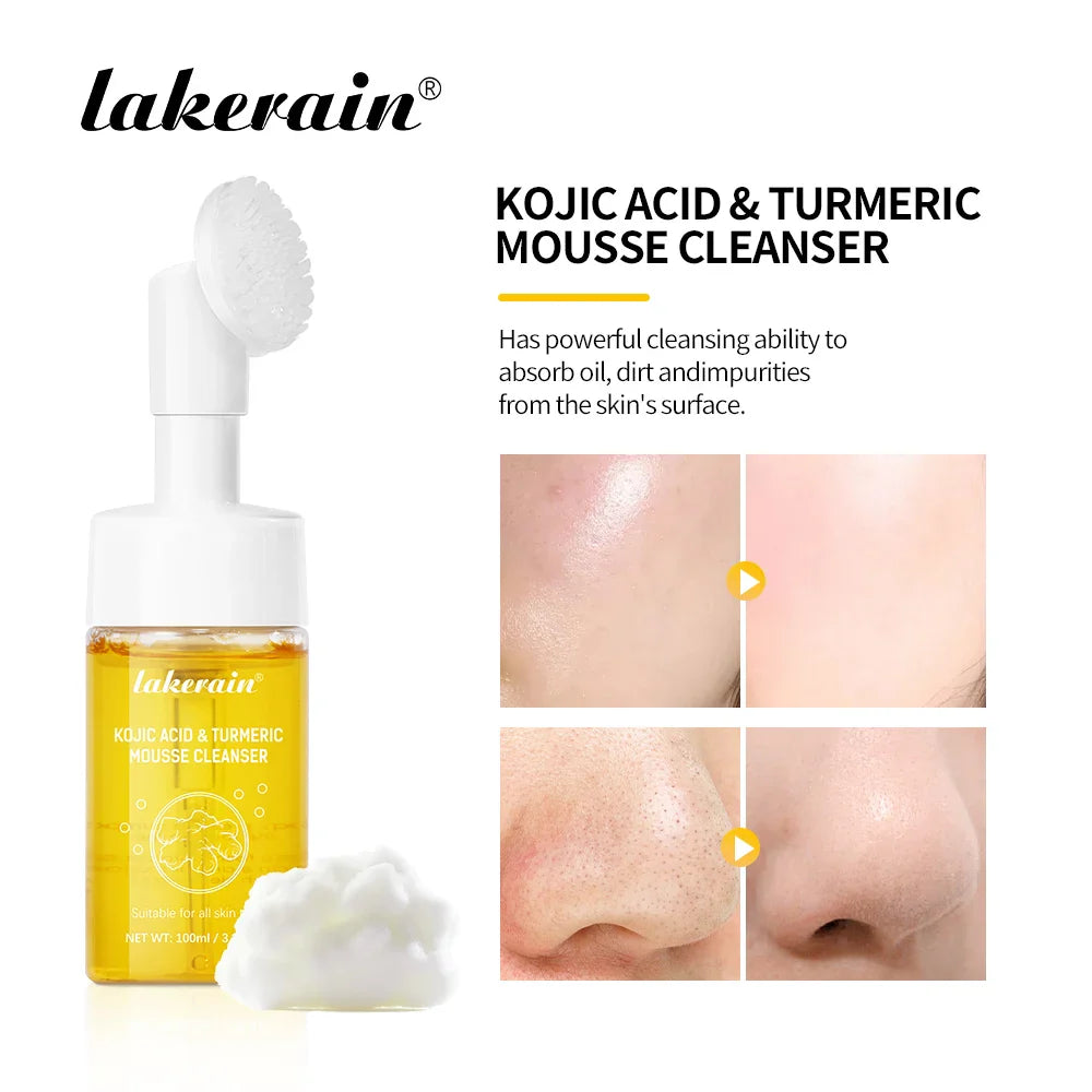 Turmeric & Kojic Acid Foaming Facial Cleanser – 100ml