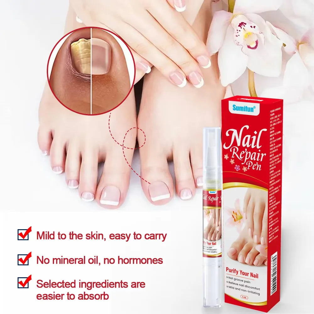 Fungal Nail Treatment Serum Foot Nail Fungus Removal Repair Gel Anti Infection Paronychia Onychomycosis Foot Nails Care Essence Peaceful Pleasures Health and Wellness