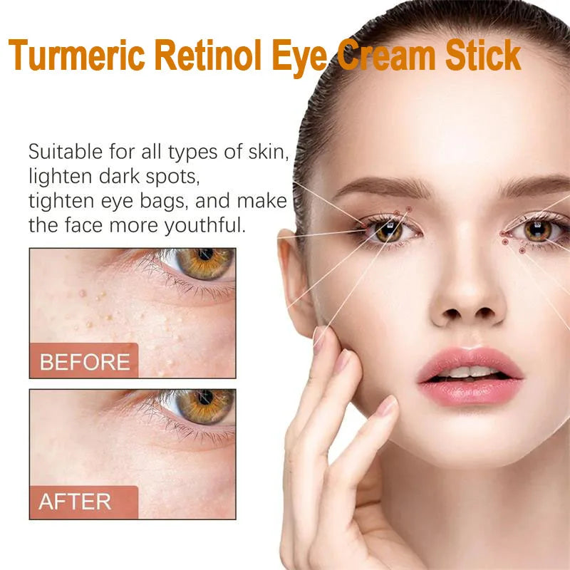 Hoygi Eye Cream | Dark Circles, Puffiness & Fine Lines