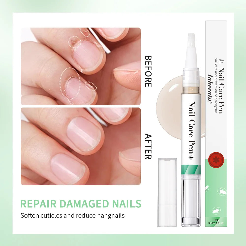 Nail Care Pen Nourish and Moisturize Nails Prevent Fungal Infections Improve Appearance Flat Brush Head Design Daily Nail Care Peaceful Pleasures Health and Wellness