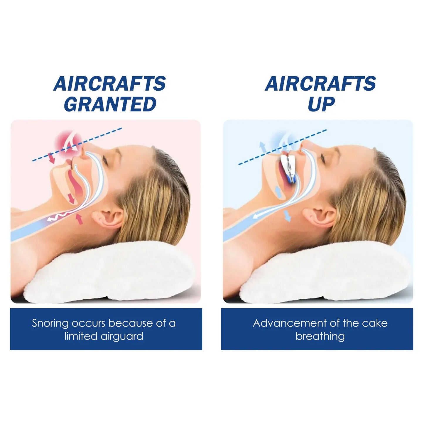 Anti-Snoring & Teeth Grinding Mouthpiece | Sleep Guard