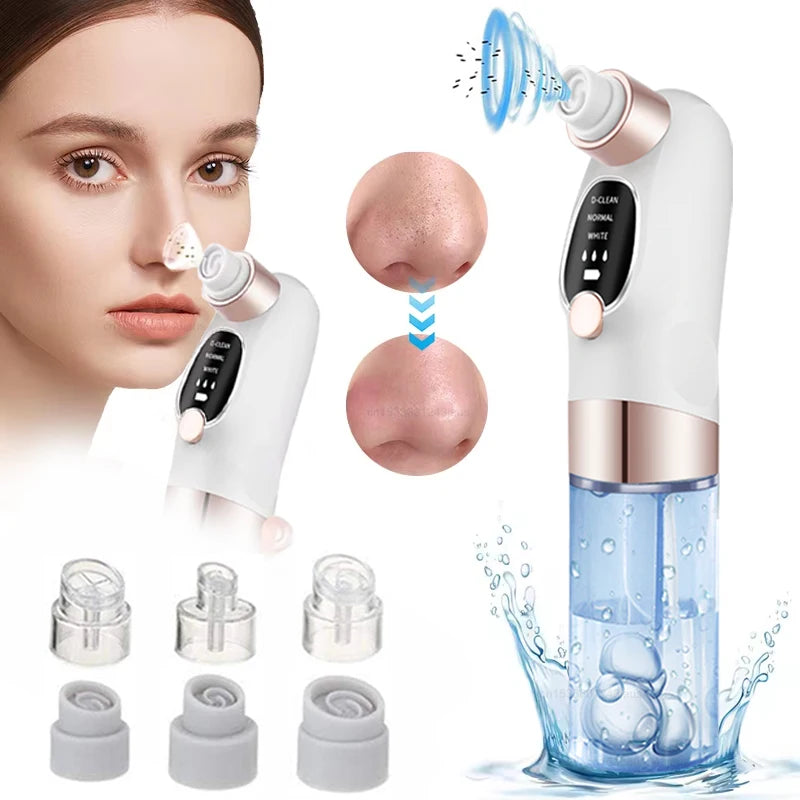 Blackhead Remover Pore Cleaner Black Dots Vacuum Cleaner Skin Pimple Acne Extractor Facial Cleaning Electric Black Head Removal Peaceful Pleasures Health and Wellness