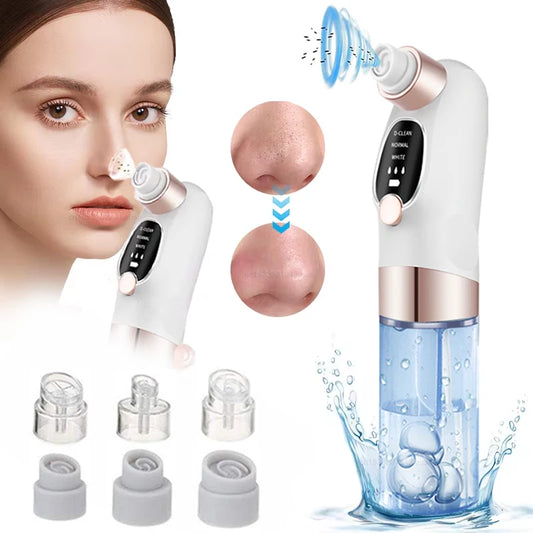 Blackhead Remover Pore Cleaner Black Dots Vacuum Cleaner Skin Pimple Acne Extractor Facial Cleaning Electric Black Head Removal Peaceful Pleasures Health and Wellness