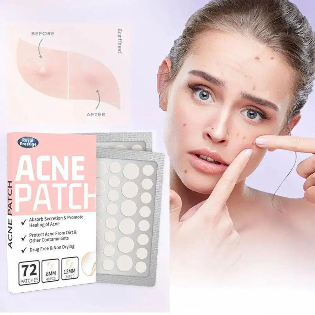 72pcs Invisible Salicylic Acid Acne Patches Anti-Acne Spot Treatment, Waterproof Pimple Concealer, Repair Stickers for Blemish Peaceful Pleasures Health and Wellness