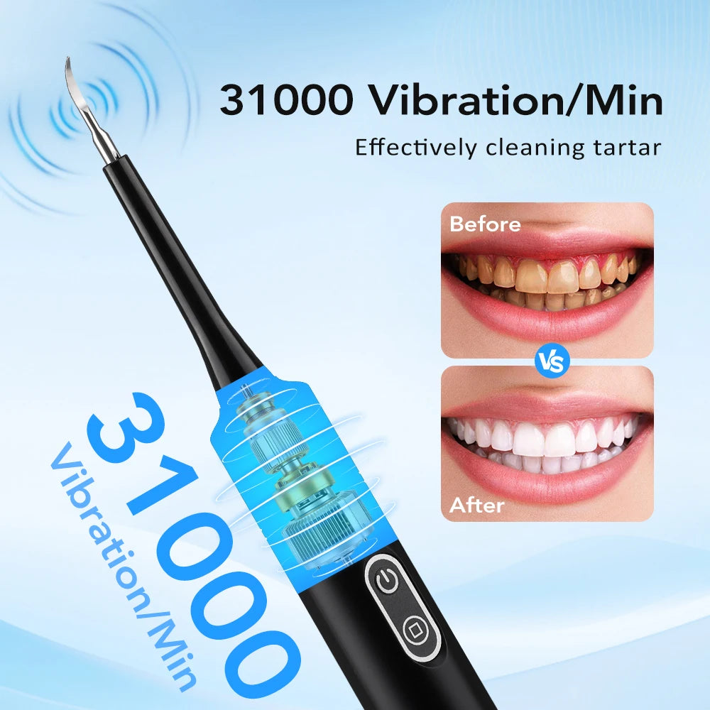 Electric Dental Scaler with Teeth Brush Head Calculus Tartar Remover Vibration Teeth Plaque Cleaner Oral Care Improve Odor Peaceful Pleasures Health and Wellness
