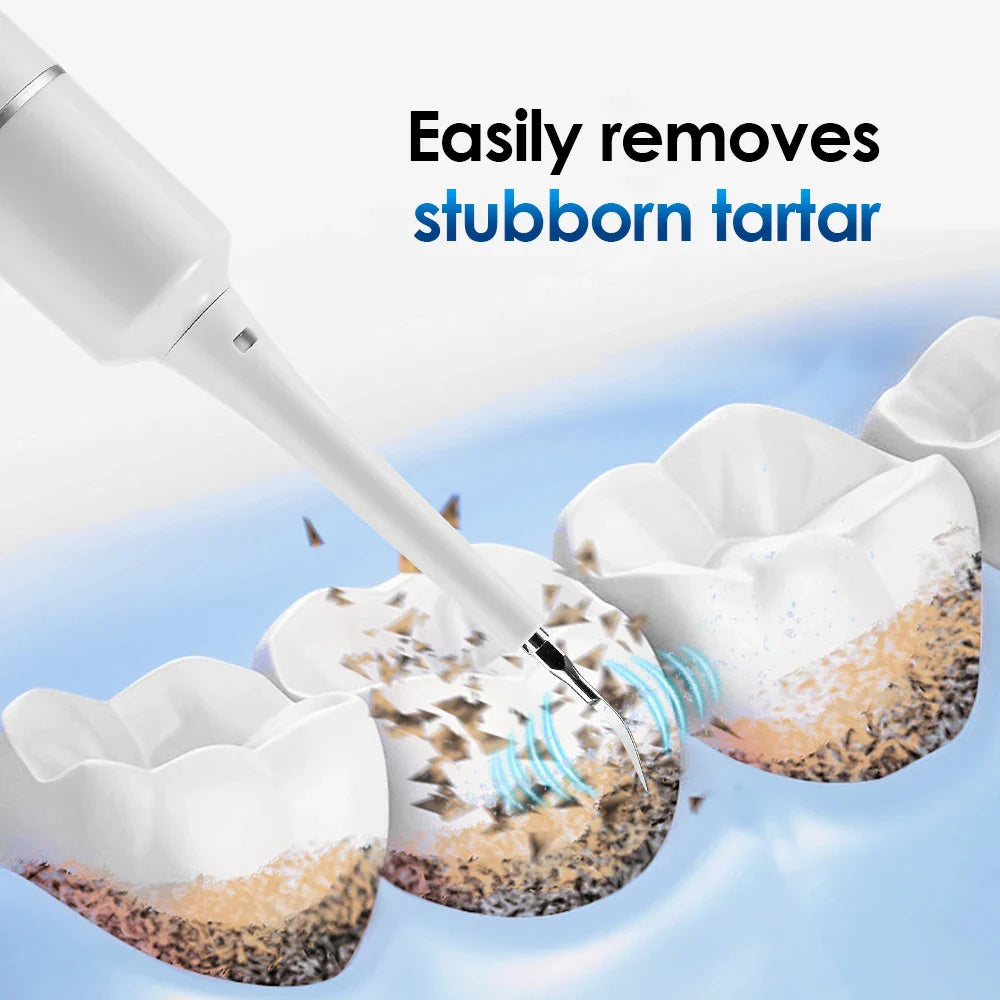 Electric Sonic Teeth Cleaner 6-Mode Tartar Remover & Whitener