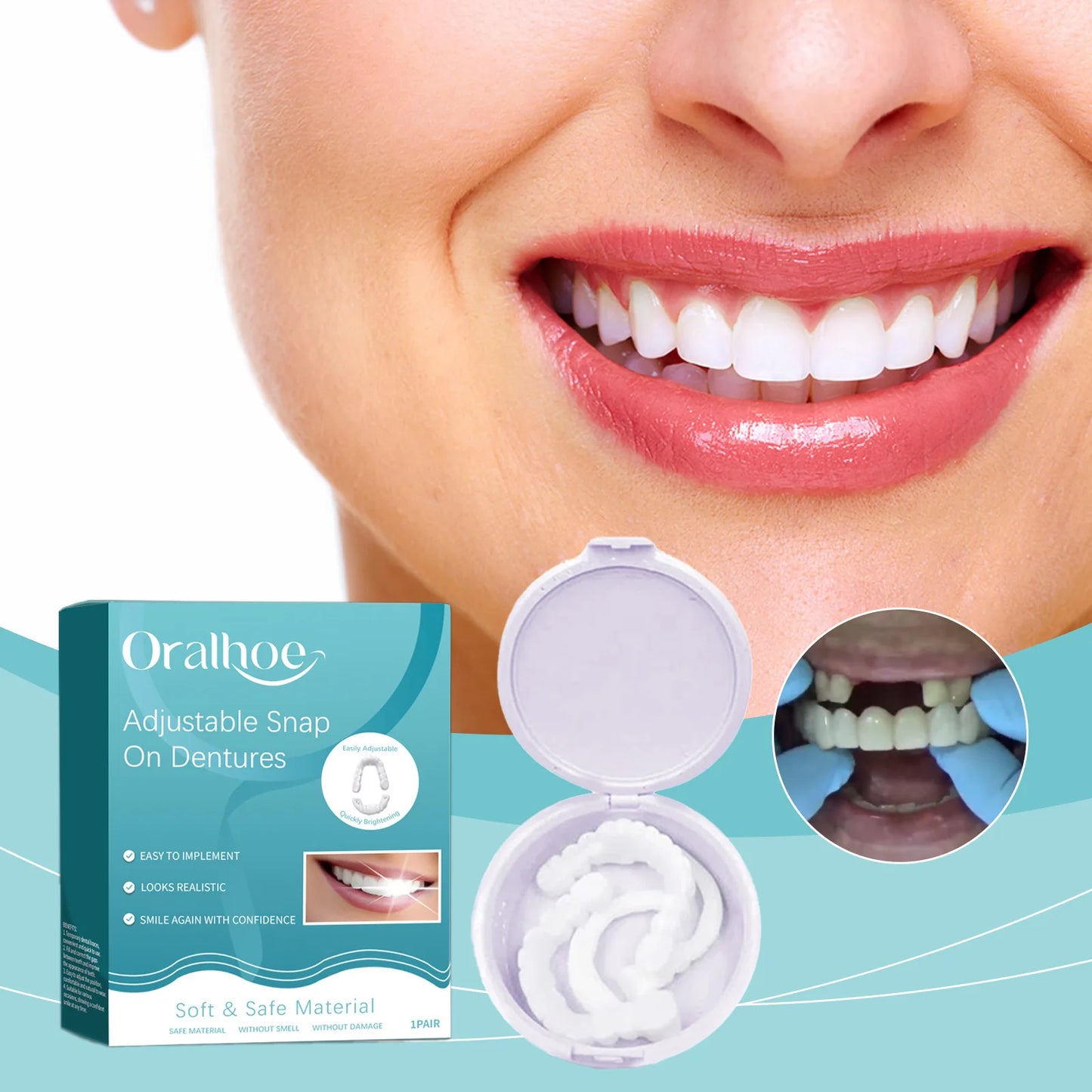Oralhoe Snap-On Veneers & Temporary Denture Kit – Perfect Smile