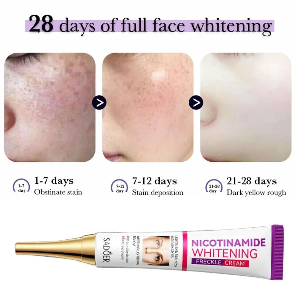 SADOER Nicotinamide Remove Melasma Dark Spot Whiten Freckle Cream Lighten Melanin Brightens Skin Tone Moisturize Face Skin Care Peaceful Pleasures Health and Wellness