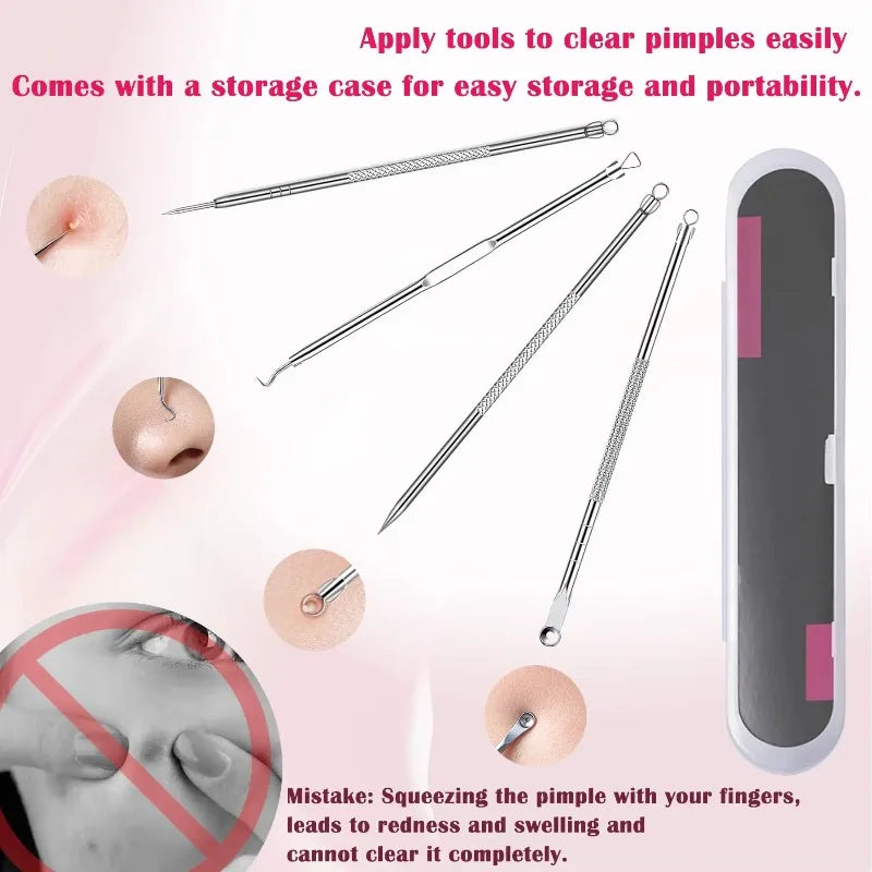 4-Pack Stainless Steel Blackhead & Comedone Extractor Kit