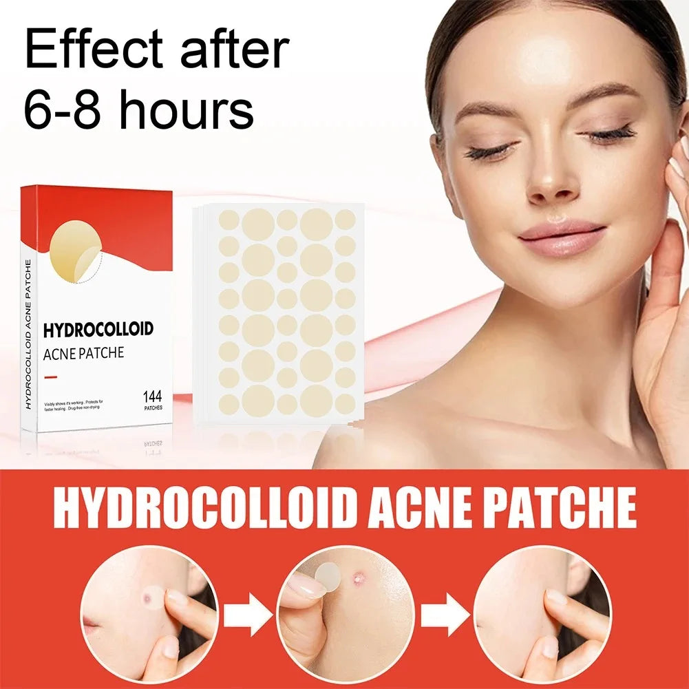 144pcs/set Face High-end Skin Care Pimple Acne Patches Professional Healing Absorbing Spot Sticker Covering for Covering Acne Peaceful Pleasures Health and Wellness