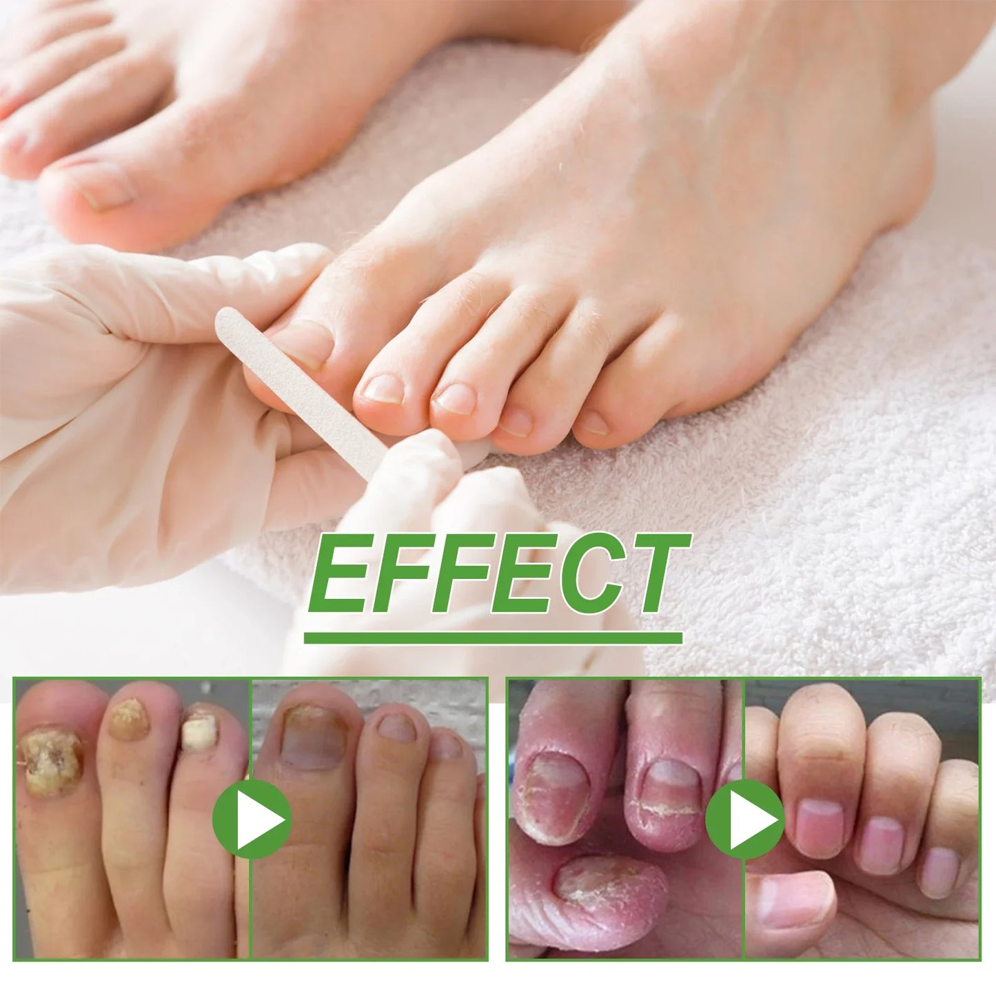 5-Day Nail Care Roller – Nourishing Nail Serum for Hand & Foot