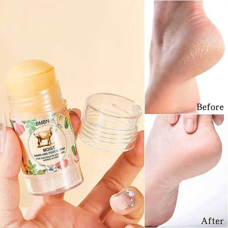 Moist Hand Foot Cream For Rough Dry Skin Deeply Repairs Cracked Skin Moisturizes Ingredient Lanolin Protective Stick Hand Cream Peaceful Pleasures Health and Wellness