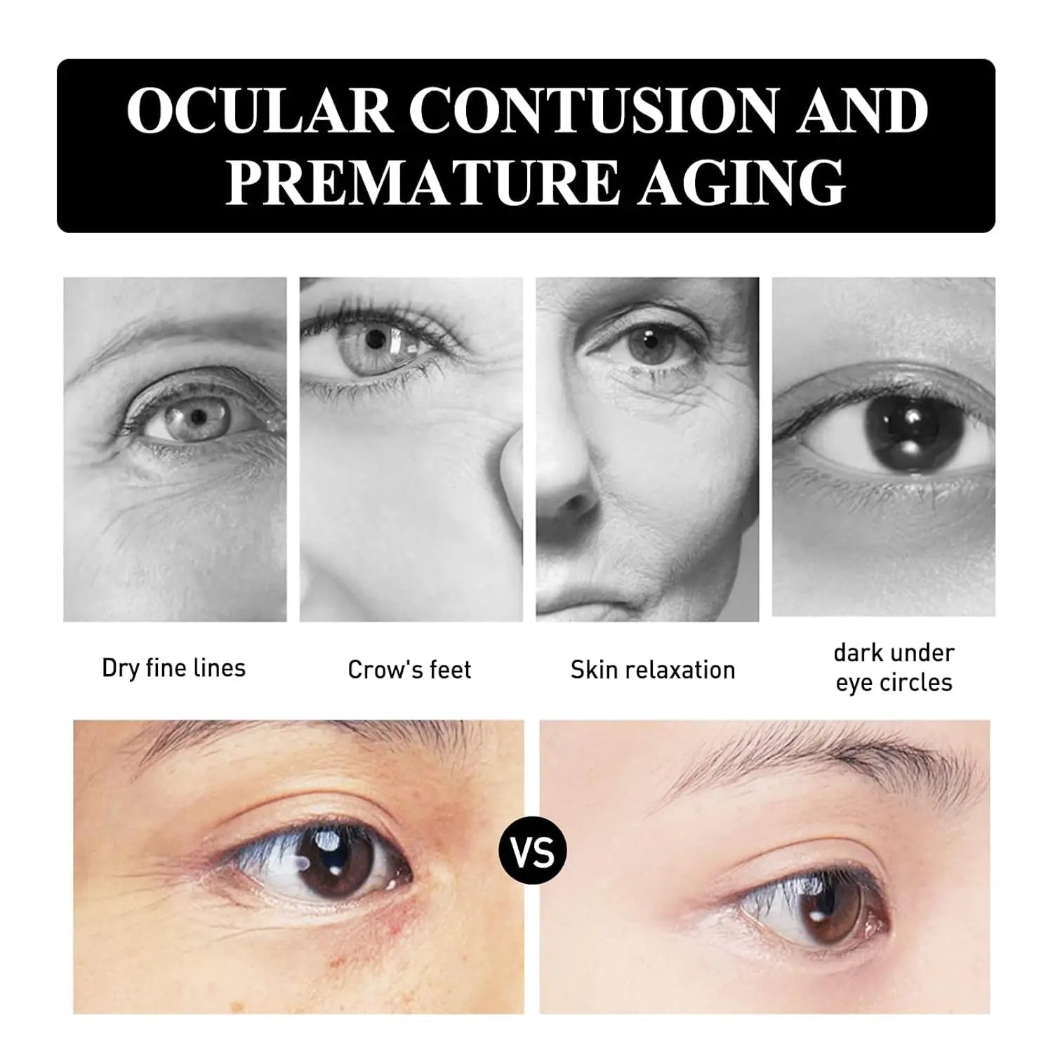 2Pcs Verfons 30G Snake Venom Peptide Eye Cream Smoothes Fine Lines And Dark Eye Cream Instant Removal Of Eye Bags Cream Peaceful Pleasures Health and Wellness