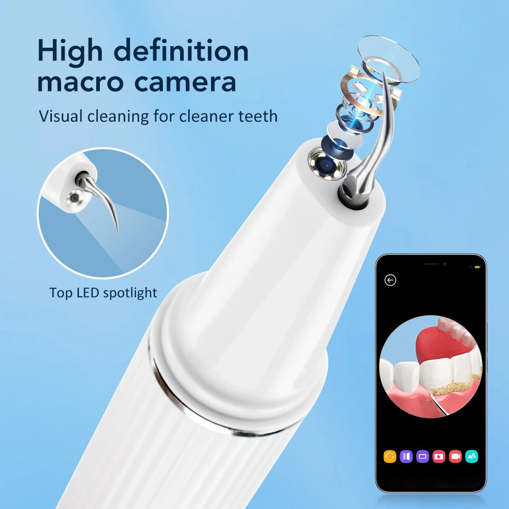 Electric Teeth Cleaner Dental Scaler Plaque Tartar Calculus Stain Remover Oral Care Rechargeable Home Use Teeth Whitening Kit Peaceful Pleasures Health and Wellness