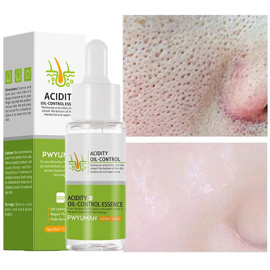 Acidity Pore Shrink Face Serum Remove Blackhead Acne Spot Oil Control Moisturizing Repair Nourish Pores Firming Smooth Skin Care Peaceful Pleasures Health and Wellness Default Title