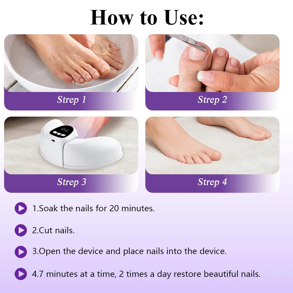 Nail Fungus Laser Device Dual Physical Light Onychomycosis Treatment Anti Fungus Infection Paronychia Nail Repair Home Use Peaceful Pleasures Health and Wellness