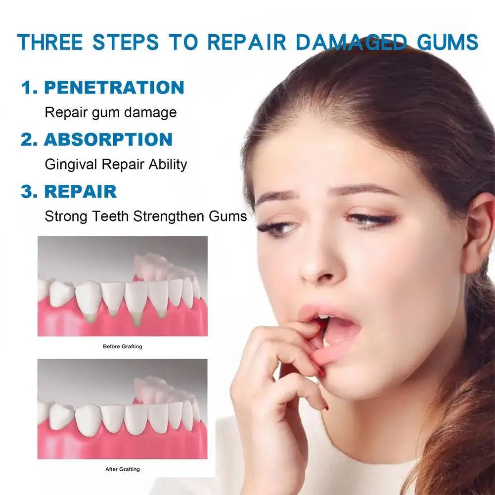 Gum Repair Drops 30ml – Soothe Sore Gums & Remove Tartar