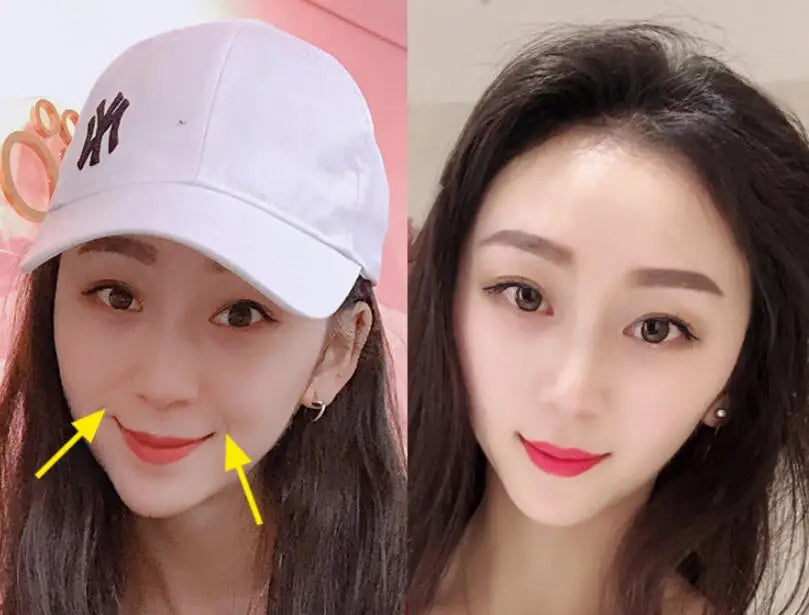 Silica Gel Jaw Exerciser – Face Slimming & Chin Lift Tool